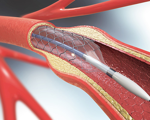 GettyImages-999350008-5x4