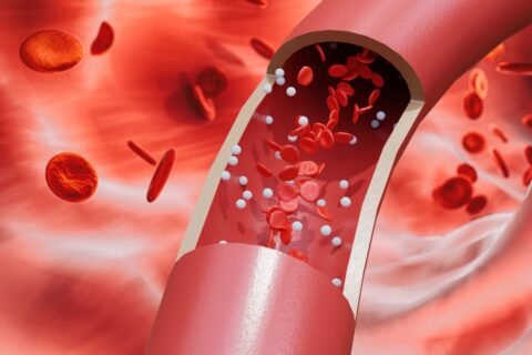 Connection Between Chronic Stress and Vein Damage Explained at Revamp Heart & Vascular Institute