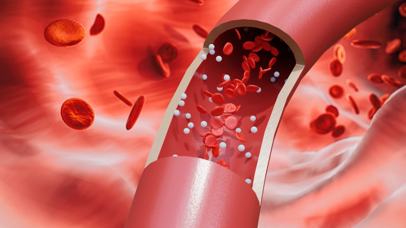 Connection Between Chronic Stress and Vein Damage Explained at Revamp Heart & Vascular Institute
