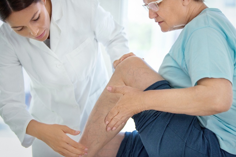 Extreme Heat Affects Blood Vessels & Circulation During Summer by ReVaMP Heart & Vascular Institute