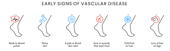 Early Signs of Vascular Disease By ReVaMP Heart & Vascular Institute