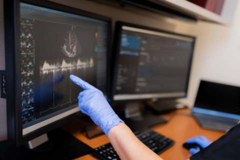 Spect Cardiac Stress Test Imaging Improving Diagnostic Accuracy at ReVaMP Heart & Vascular Institute