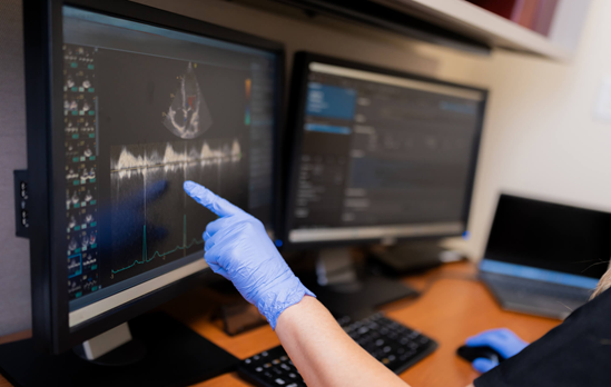 Spect Cardiac Stress Test Imaging Improving Diagnostic Accuracy at ReVaMP Heart & Vascular Institute