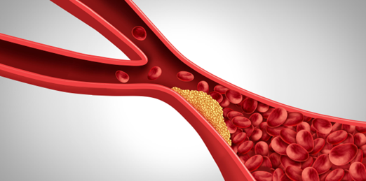 Triglyceride-Rich Lipoproteins and Vascular Risk By ReVaMP Heart & Vascular Institute